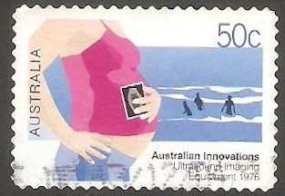 2207 - Innovación australiana, ultrasonidos para mujer embarazada
